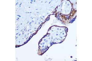 Immunohistochemistry of paraffin-embedded human placenta using RhoA Rabbit pAb (ABIN3020848, ABIN3020849, ABIN3020850 and ABIN6213755) at dilution of 1:100 (40x lens). (RHOA 抗体  (C-Term))