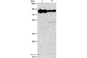 Western blot analysis of Mouse brain and human brain malignant glioma tissue, using KIF3A Polyclonal Antibody at dilution of 1:750 (KIF3A 抗体)