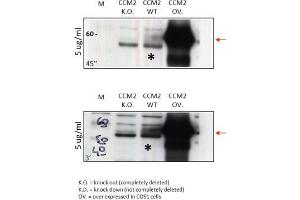 Western Blot Analysis of anti-human CCM-2. (CCM2 抗体  (N-Term))