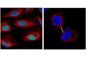ICC/IF Image Confocal immunofluorescence analysis (Olympus FV10i) of paraformaldehyde-fixed U2OS, using Survivin, antibody (Geen) at 1:500 dilution. (Survivin 抗体)