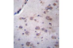 Immunohistochemistry (Paraffin-embedded Sections) (IHC (p)) image for anti-NADH Dehydrogenase (Ubiquinone) 1 alpha Subcomplex, Assembly Factor 4 (NDUFAF4) (AA 32-61), (N-Term) antibody (ABIN953631)