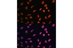 Immunofluorescence (IF) image for anti-ADP-Ribosyltransferase 1 (ART1) (AA 23-295) antibody (ABIN6137152)