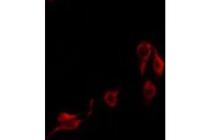 Immunofluorescence (fixed cells) (IF/ICC) image for anti-Insulin-Like Growth Factor Binding Protein, Acid Labile Subunit (IGFALS) (Internal Region) antibody (ABIN6258855)