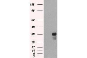 HEK293T cells were transfected with the pCMV6-ENTRY control (Left lane) or pCMV6-ENTRY CD2 (Right lane) cDNA for 48 hrs and lysed. (CD2 抗体)