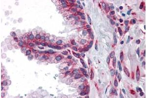 Human Prostate: Formalin-Fixed, Paraffin-Embedded (FFPE) (MTDH 抗体)