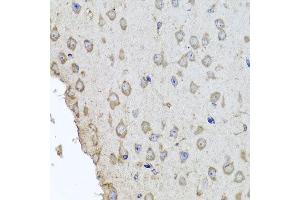 Immunohistochemistry of paraffin-embedded mouse brain using HBA2 antibody at dilution of 1:100 (x40 lens). (HBa2 抗体)