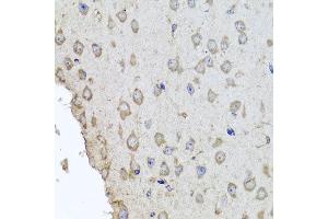 Immunohistochemistry of paraffin-embedded mouse brain using HBA2 antibody at dilution of 1:100 (x40 lens).
