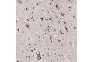 Immunohistochemical staining of human cerebral cortex with ZNF777 polyclonal antibody  shows strong nuclear positivity in neuronal and glial cells. (ZNF777 抗体)