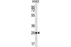 ZNF146 Antibody (N-term) western blot analysis in K562 cell line lysates (35 µg/lane). (ZNF146 抗体  (N-Term))