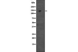 Western blot analysis of CCAR1 expression in Hela cell lysate,The lane on the left is treated with the antigen-specific peptide. (CCAR1 抗体  (Internal Region))