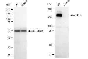 Western blotting analysis using EGFR antibody (ABIN7798461). (Recombinant EGFR 抗体)