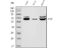 Western blot analysis of PINK1 using anti-PINK1 antibody (ABIN7599749).
