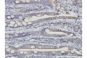 Immunostaining (ISt) image for anti-Endoplasmic Reticulum Protein 44 (ERP44) (AA 30-406) antibody (ABIN565003)