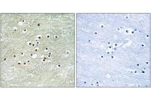 Immunohistochemistry analysis of paraffin-embedded human brain tissue, using NPAS4 Antibody. (NPAS4 抗体  (AA 603-652))