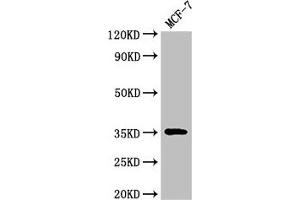 Western Blot Positive WB detected in: MCF-7 whole cell lysate All lanes: ACY3 antibody at 3 μg/mL Secondary Goat polyclonal to rabbit IgG at 1/50000 dilution Predicted band size: 36 kDa Observed band size: 36 kDa (Aminoacylase 3 抗体  (AA 5-319))