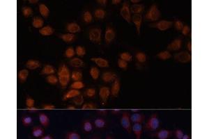 Immunofluorescence analysis of HeLa cells using ADAM15 Polyclonal Antibody at dilution of 1:100 (40x lens). (ADAM15 抗体)