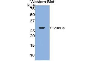 Detection of Recombinant NF2, Human using Polyclonal Antibody to Neurofibromin 2 (NF2) (Merlin 抗体  (AA 30-239))
