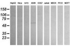 Western Blotting (WB) image for anti-Aldehyde Dehydrogenase 1 Family, Member A3 (ALDH1A3) (AA 1-100), (AA 413-512) antibody (ABIN2715887)