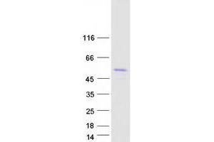 Transforming Growth Factor beta 1 Induced Transcript 1 (TGFB1I1) (Transcript Variant 3) protein (Myc-DYKDDDDK Tag)