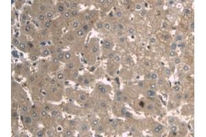 Detection of a1BG in Human Liver Tissue using Monoclonal Antibody to Alpha-1-B-Glycoprotein (a1BG) (A1BG 抗体  (AA 22-206))