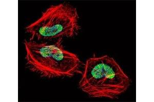Fluorescent confocal image of HeLa cell stained with HDAC4 antibody at 1:25. (HDAC4 抗体  (AA 1049-1077))