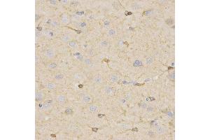 Immunohistochemistry (IHC) image for anti-Hydroxysteroid (17-Beta) Dehydrogenase 2 (HSD17B2) antibody (ABIN1873085) (HSD17B2 抗体)