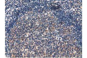 Immunohistochemical staining of paraffin-embedded Human lymph node tissue using anti-CBWD1 mouse monoclonal antibody. (CBWD1 抗体)