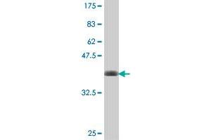 Western Blot detection against Immunogen (38. (Clathrin Heavy Chain (CLTC) (AA 232-340) 抗体)