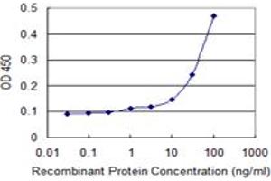 Detection limit for recombinant GST tagged SSH1 is 3 ng/ml as a capture antibody. (SSH1 抗体  (AA 752-849))