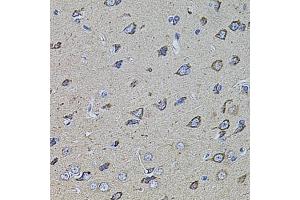 Immunohistochemistry of paraffin-embedded rat brain using HMMR antibody (ABIN5971368) at dilution of 1/100 (40x lens). (HMMR 抗体)