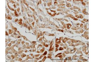 Immunostaining (ISt) image for anti-Heat Shock 27kDa Protein Family, Member 7 (Cardiovascular) (HSPB7) (AA 1-170) antibody (ABIN565338)