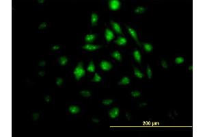 Immunofluorescence of monoclonal antibody to KLF10 on HeLa cell. (KLF10/TIEG1 抗体  (AA 1-110))