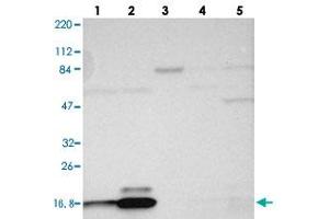 Western blot analysis of Lane 1: RT-4, Lane 2: U-251 MG, Lane 3: Human Plasma, Lane 4: Liver, Lane 5: Tonsil with RPL27 polyclonal antibody . (RPL27 抗体)