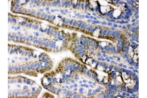 Immunohistochemistry (IHC) image for anti-3-phosphoinositide Dependent Protein Kinase-1 (PDPK1) (AA 524-556), (C-Term) antibody (ABIN3043600)