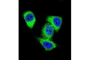 Confocal immunofluorescent analysis of TOP2A Antibody (C-term) (ABIN653195 and ABIN2842744) with Hela cell followed by Alexa Fluor 488-conjugated goat anti-rabbit lgG (green).