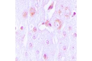 Immunohistochemical analysis of Tyrosine Hydroxylase staining in human brain formalin fixed paraffin embedded tissue section. (Tyrosine Hydroxylase 抗体  (N-Term))