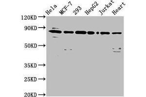 Western Blot Positive WB detected in: Hela whole cell lysate, MCF-7 whole cell lysate, 293 whole cell lysate, HepG2 whole cell lysate, Jurkat whole cell lysate, Mouse heart tissue All lanes: LETM1 antibody at 6. (LETM1 抗体  (AA 443-543))