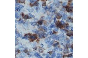 Immunohistochemical analysis of CD32b staining in human lymph node formalin fixed paraffin embedded tissue section. (FCGR2B 抗体  (C-Term))