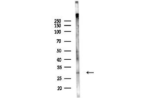 Western blot analysis of lysates from Hela cells(starvation,24h treatment), using HLA-DR Antibody at 1/1000 dilution.