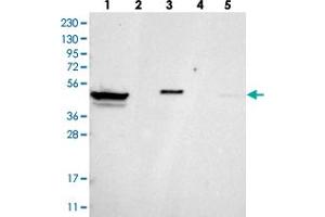 Western blot analysis of Lane 1: RT-4, Lane 2: U-251 MG, Lane 3: Human Plasma, Lane 4: Liver, Lane 5: Tonsil with ZNF774 polyclonal antibody . (ZNF774 抗体)