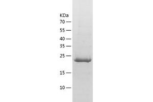 Western Blotting (WB) image for Stanniocalcin 1 (STC1) (AA 39-247) protein (His tag) (ABIN7125205) (Stanniocalcin 1 Protein (STC1) (AA 39-247) (His tag))