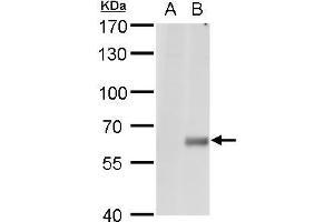 WB Image Copine I antibody [N1N3] detects Copine I protein by western blot analysis. (CPNE1 抗体  (N-Term))