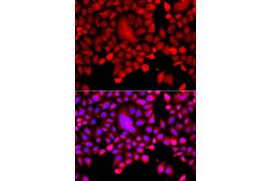 Immunofluorescence analysis of A549 cell using TDP1 antibody. (TDP1 抗体)