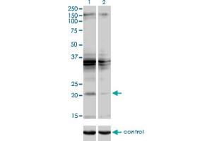 Western blot analysis of SCAND2 over-expressed 293 cell line, cotransfected with SCAND2 Validated Chimera RNAi (Lane 2) or non-transfected control (Lane 1). (SCAND2 抗体  (AA 1-62))