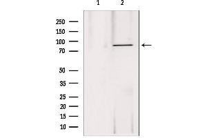 Western blot analysis of extracts from 293, using DDX21 antibody. (DDX21 抗体  (Internal Region))