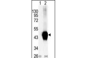 Western blot analysis of BCKDK (arrow) using rabbit polyclonal BCKDK Antibody (C-term ) (R). (BCKDK 抗体  (C-Term))