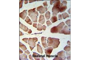 PATL1 Antibody IHC analysis in formalin fixed and paraffin embedded skeletal muscle followed by peroxidase conjugation of the secondary antibody and DAB staining. (PATL1 抗体  (C-Term))