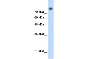 WB Suggested Anti-MCM6 Antibody Titration:  0. (MCM6 抗体  (C-Term))