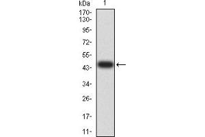 Western blot analysis using NAA10 mAb against human NAA10 (AA: 111-235) recombinant protein. (NAA10 抗体  (AA 111-235))