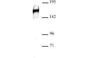 Drosha antibody (pAb) tested by Western blot. (DROSHA 抗体  (C-Term))